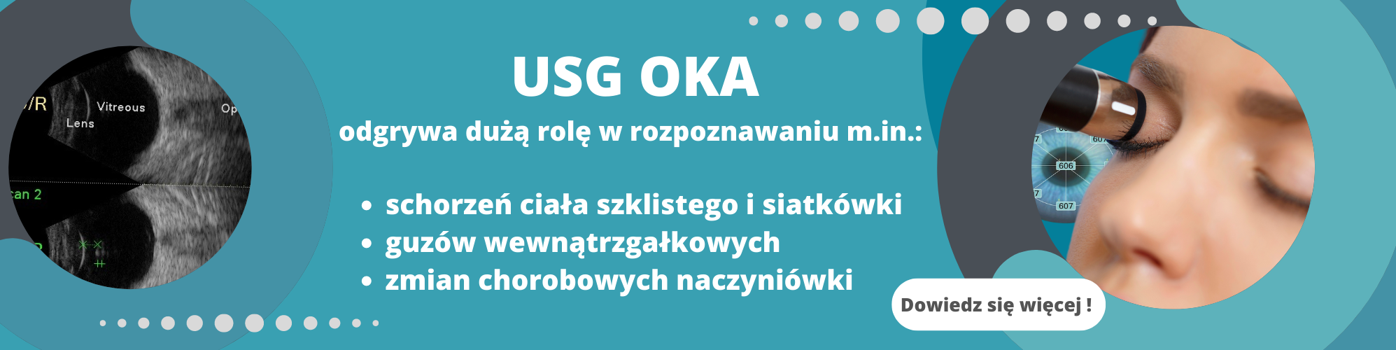 Diagnostyka ultrasonograficzna - USG oka - cmkasprzaka.pl